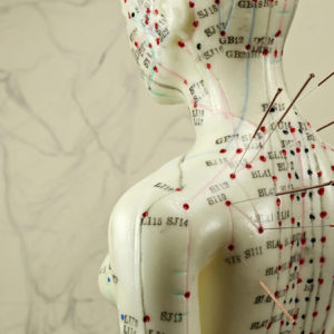 acupuncture-great-neck-ny-2-2